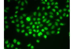 Immunofluorescence analysis of HeLa cells using SMARCE1 antibody. (SMARCE1 anticorps)