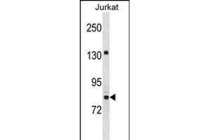 UHRF2 Antibody (Center) (ABIN1538450 and ABIN2850120) western blot analysis in Jurkat cell line lysates (35 μg/lane). (UHRF2 anticorps  (AA 479-508))