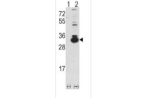 Western blot analysis of KHK using rabbit polyclonal Ketohexokinase (KHK) Antibody using 293 cell lysates (2 ug/lane) either nontransfected (Lane 1) or transiently transfected with the KHK gene (Lane 2). (Ketohexokinase anticorps  (C-Term))