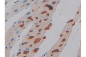 Detection of PDL1 in Mouse Heart Tissue using Polyclonal Antibody to Programmed Cell Death Protein 1 Ligand 1 (PDL1)