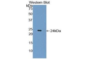 Western Blotting (WB) image for anti-Interleukin 1 Receptor Antagonist (IL1RN) (AA 26-176) antibody (ABIN1172590) (IL1RN anticorps  (AA 26-176))