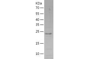 Western Blotting (WB) image for Synovial Sarcoma, X Breakpoint 5 (SSX5) (AA 1-188) protein (His tag) (ABIN7125288)