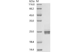 (Tris-Glycine gel) Discontinuous SDS-PAGE (reduced) with 5 % enrichment gel and 15 % separation gel.