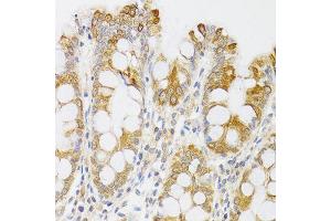 Immunohistochemistry of paraffin-embedded human rectum using MYO5A antibody (ABIN6003562) at dilution of 1/100 (40x lens).