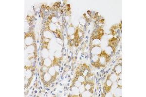 Immunohistochemistry of paraffin-embedded human rectum using MYO5A antibody (ABIN6003562) at dilution of 1/100 (40x lens). (MYO5A anticorps)