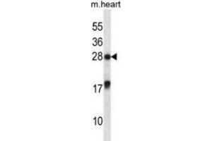 Western blot analysis in mouse heart tissue lysates (35ug/lane) using MXI1 Antibody . (MXI1 anticorps  (Middle Region))