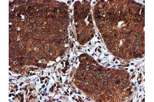 Image no. 12 for anti-Chromosome 1 Open Reading Frame 50 (C1ORF50) antibody (ABIN1497033)