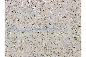 CCDC98 Antibody at 1/100 staining rat brain tissue by IHC-P. (CCDC98 anticorps)