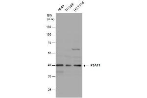 WB Image PSAT1 antibody [N1C3] detects PSAT1 protein by western blot analysis. (PSAT1 anticorps)