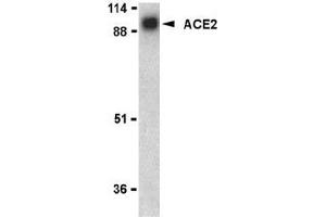 Western blot analysis of ACE2 in human kidney lysate with AP30008PU-N ACE2 antibody at 1 μg/ml. (ACE2 anticorps  (N-Term))