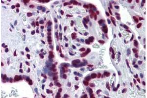 Human Placenta: Formalin-Fixed, Paraffin-Embedded (FFPE)