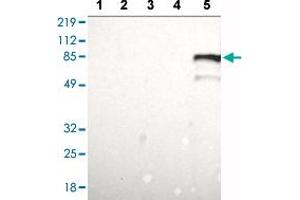 Western blot analysis of Lane 1: RT-4 cell lysate, Lane 2: U-251 MG sp cell lysate, Lane 3: A-431 cell lysate, Lane 4: Human liver tissue, Lane 5: Human tonsil tissue with BTK polyclonal antibody  at 1:100 - 1:250 dilution. (BTK anticorps  (AA 206-351))