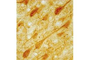 IHC image of neurons in rat cortex. (Serotonin Receptor 1A anticorps  (AA 294-312))