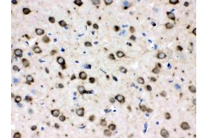IHC analysis of TCP1 delta using anti- TCP1 delta antibody .