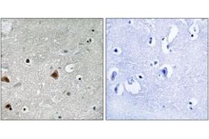 Immunohistochemistry analysis of paraffin-embedded human brain, using COPS1 (Phospho-Ser454) Antibody. (GPS1 anticorps  (pSer454))