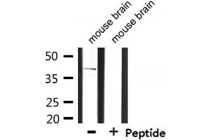 Western blot analysis of extracts from mouse brain, using CD2 Tail-binding Antibody. (CD2BP2 anticorps  (Internal Region))