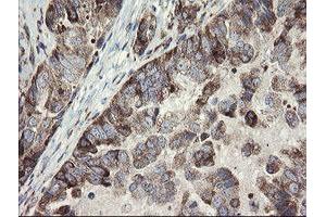 Image no. 6 for anti-Methionyl Aminopeptidase 2 (METAP2) (AA 2-212) antibody (ABIN1491153) (METAP2 anticorps  (AA 2-212))