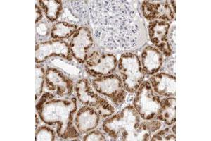 Immunohistochemical staining of human kidney with CNBD1 polyclonal antibody  shows strong cytoplasmic positivity in cells in tubules at 1:200-1:500 dilution.