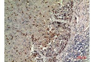 Immunohistochemistry (IHC) analysis of paraffin-embedded Human Lung, antibody was diluted at 1:100.