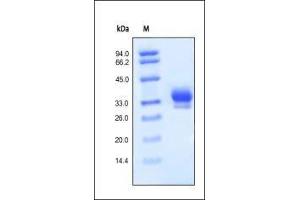 SDS-PAGE (SDS) image for Interleukin 29 (IL29) (AA 20-200) protein (His tag) (ABIN2181309)