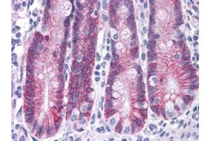 Human Small Intestine: Formalin-Fixed, Paraffin-Embedded (FFPE) (ASAH2 anticorps  (C-Term))