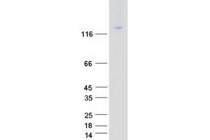 Integrin alpha-L (ITGAL) (Transcript Variant 1) protein (Myc-DYKDDDDK Tag)