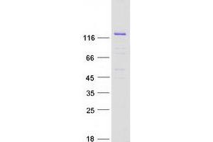 Validation with Western Blot