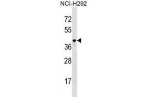 Western Blotting (WB) image for anti-V-Set and Immunoglobulin Domain-Containing Protein 4 (VSIG4) antibody (ABIN3000551) (VSIG4 anticorps)