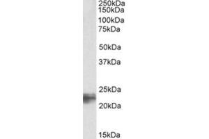 Image no. 1 for anti-Transgelin (TAGLN) (C-Term) antibody (ABIN374407) (Transgelin anticorps  (C-Term))