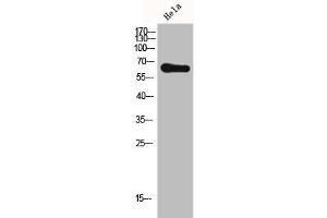Western Blot analysis of HELA cells using Frizzled-7 Polyclonal Antibody