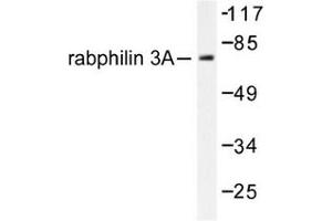 Image no. 1 for anti-Rabphilin 3A (RPH3A) antibody (ABIN272075) (RPH3A anticorps)