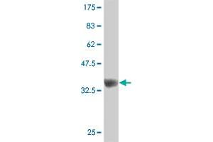 Western Blot detection against Immunogen (37. (ZNF207 anticorps  (AA 1-110))