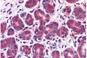Human Breast: Formalin-Fixed, Paraffin-Embedded (FFPE) (Retinoblastoma Binding Protein 8 anticorps  (AA 452-747))