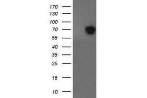 Western Blotting (WB) image for anti-ALX Homeobox 4 (ALX4) antibody (ABIN1496621) (ALX4 anticorps)