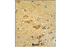 Formalin-fixed and paraffin-embedded human brain reacted with OMD Antibody (Center), which was peroxidase-conjugated to the secondary antibody, followed by DAB staining. (Osteomodulin anticorps  (AA 234-263))