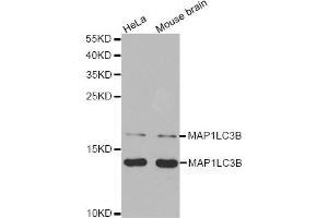 Western Blotting (WB) image for anti-Microtubule-Associated Protein 1 Light Chain 3 beta (MAP1LC3B) antibody (ABIN1876926) (LC3B anticorps)
