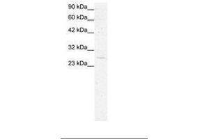 Image no. 3 for anti-YEATS Domain Containing 4 (AA 158-207) antibody (ABIN6735809) (GAS41 anticorps  (AA 158-207))