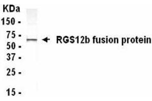 Western Blotting (WB) image for anti-Regulator of G-Protein Signalling 12 (RGS12) (AA 1372-1447) antibody (ABIN2467877) (RGS12 anticorps  (AA 1372-1447))