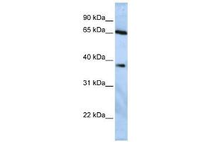 USP3 antibody used at 1. (USP3 anticorps  (Middle Region))