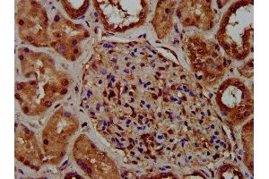 IHC image of ABIN7149368 diluted at 1:400 and staining in paraffin-embedded human kidney tissue performed on a Leica BondTM system. (CKAP5 anticorps  (AA 1802-2019))