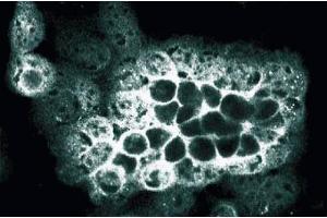 Immunofluorescence staining of A431 cells (ALOX5 anticorps  (AA 442-590))