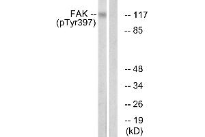 Immunohistochemistry analysis of paraffin-embedded human brain tissue using FAK (Phospho-Tyr397) antibody. (FAK anticorps  (pTyr397))