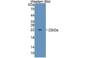 Detection of Recombinant DPPA3, Human using Polyclonal Antibody to Developmental Pluripotency Associated Protein 3 (DPPA3) (DPPA3 anticorps  (AA 1-159))