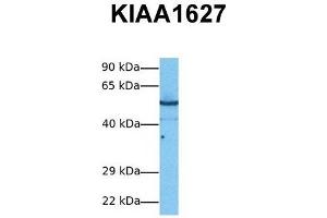 Host:  Rabbit  Target Name:  KIAA1627  Sample Tissue:  Human PANC1  Antibody Dilution:  1. (KIAA1627 anticorps  (N-Term))