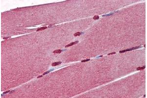 Human Skeletal Muscle (formalin-fixed, paraffin-embedded) stained with  antibody ABIN462276 followed by biotinylated secondary antibody, alkaline phosphatase-streptavidin and chromogen. (CRABP1 anticorps  (AA 1-137))