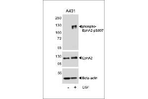 Western blot analysis of lysates from A431 cell line, untreated or treated with EGF, 100 ng/mL, using phospho-EphA2-p A (upper), EphA2 (middle) or Beta-actin (lower). (EPH Receptor A2 anticorps  (pSer897))
