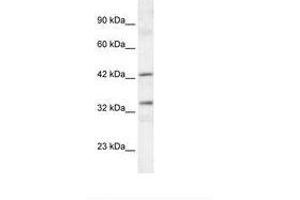 Image no. 2 for anti-TATA Box Binding Protein (TBP)-Associated Factor, RNA Polymerase I, A, 48kDa (TAF1A) (C-Term) antibody (ABIN6735836) (TAF1A anticorps  (C-Term))