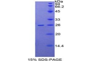 SDS-PAGE (SDS) image for Dimethylarginine Dimethylaminohydrolase 1 (DDAH1) (AA 20-215) protein (His tag) (ABIN1878880) (DDAH1 Protein (AA 20-215) (His tag))