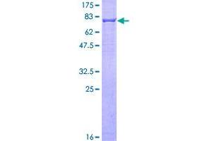 Image no. 1 for Keratin 6A (KRT6A) (AA 1-564) protein (GST tag) (ABIN1309014)