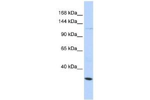 KCNMA1 antibody used at 1 ug/ml to detect target protein. (KCNMA1 anticorps  (Middle Region))
